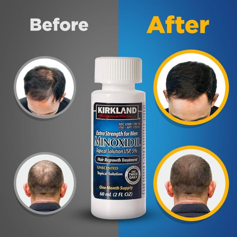 Minoxidil Liquid Extra Strength Hair Regrowth Treatment for Men - Image 2
