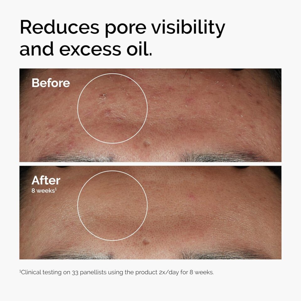 The Ordinary Niacinamide 10% + Zinc 1%: 60 mL - Image 2